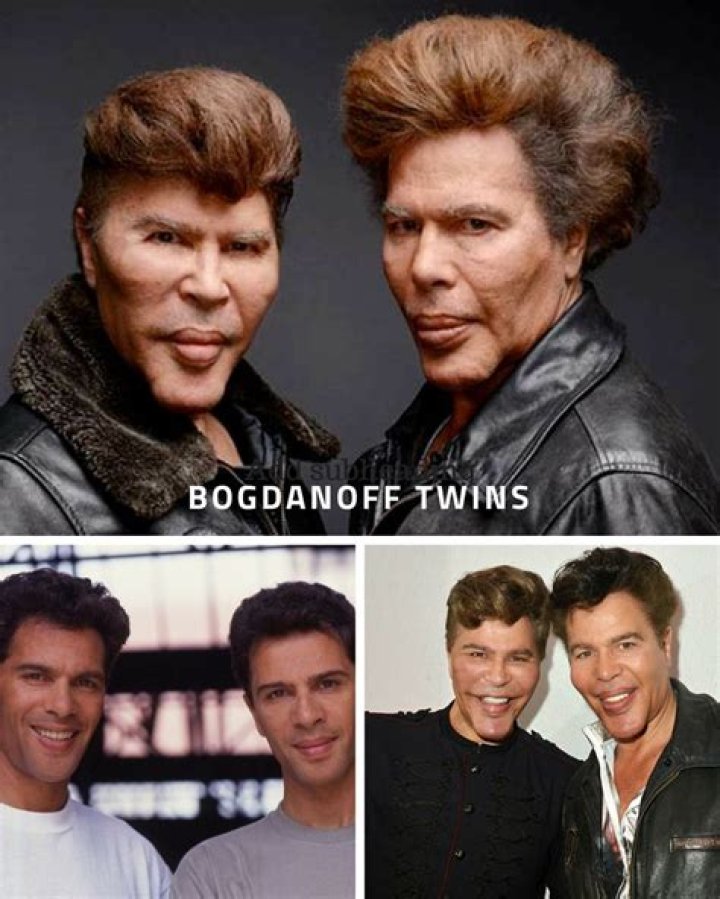 Why Did The Bogdanoff Twins Look So Different?
